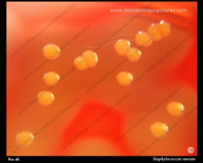 staphylococcus%20aureus%20033