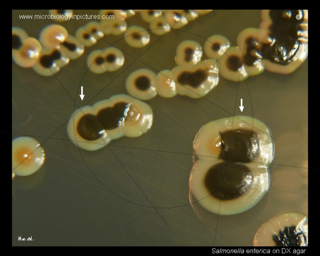 deoxycholate-citrate-dx-agar