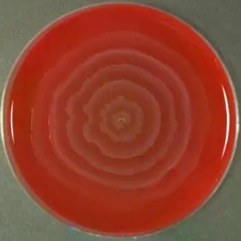 Proteus-mirabilis-in-blood-agar