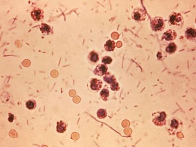Photomicrograph-Shigella