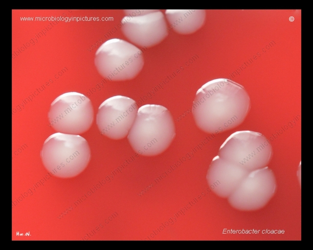 enterobacter-cloacae-colony-morphology