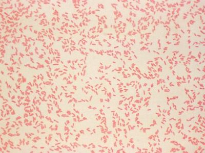 Photomicrograph-Gram-stain-yersiniosis-Yersinia-enterocolitica-agent