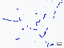 Gram stain of Streptococcus pyogenes