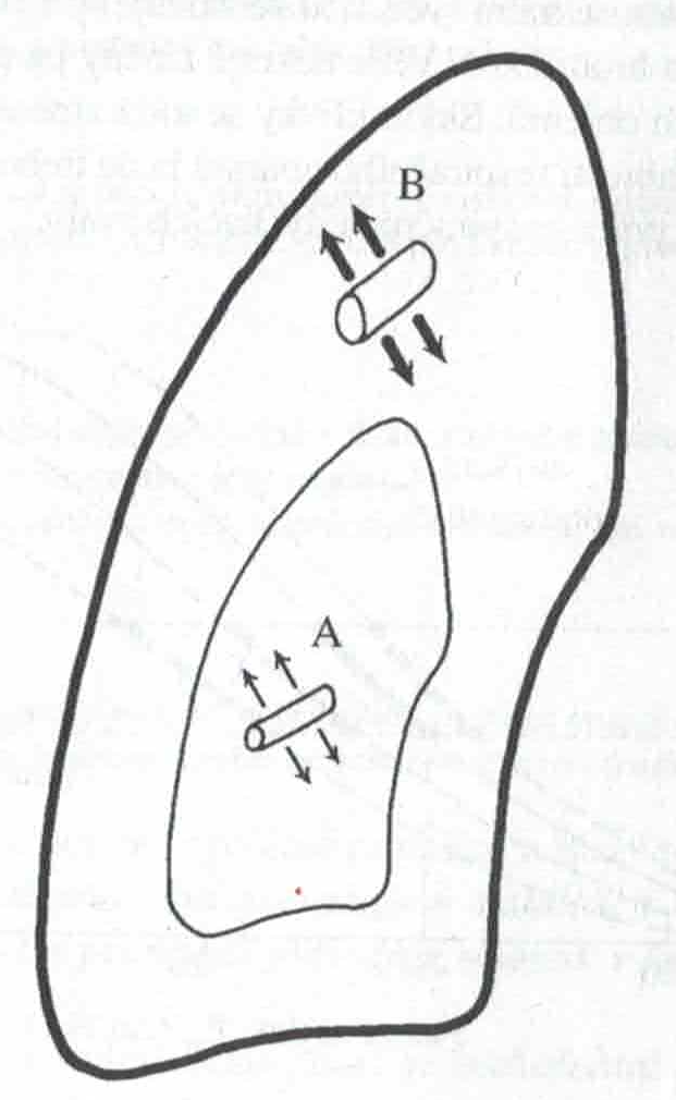 Vliv plicního objemu na průsvit dechových cest