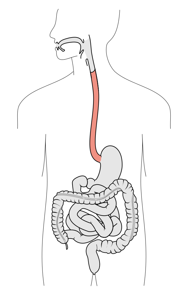 Tractus intestinalis esophagus