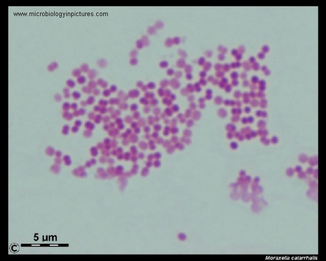 moraxella-catarrhalis-gram-stain