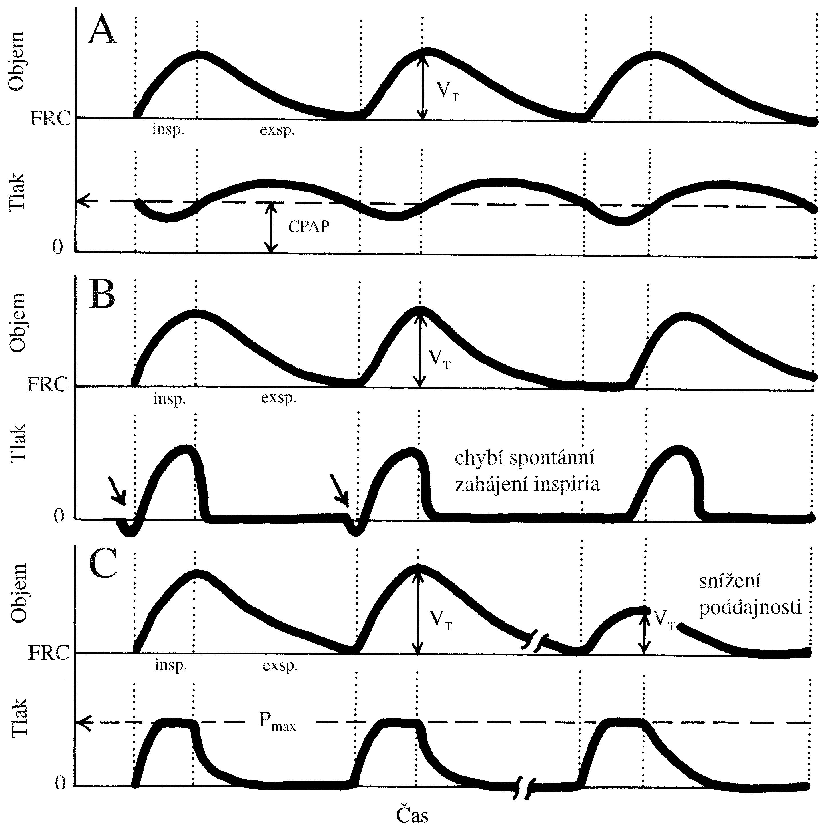 2021 Patologicka fyzio 1 Page 338 Image 0001