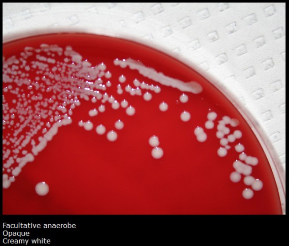 Staphylococcus-saprophyticus-570x485