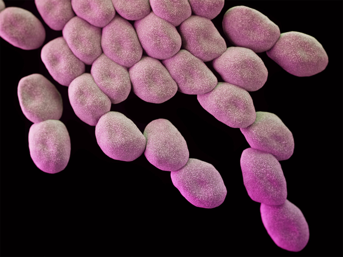 Multidrug-resistant-A-baumannii