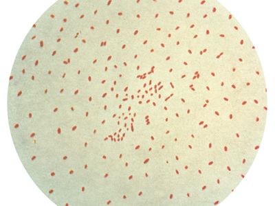 Bordetella-pertussis-whooping-cough-agent-stain-Gram