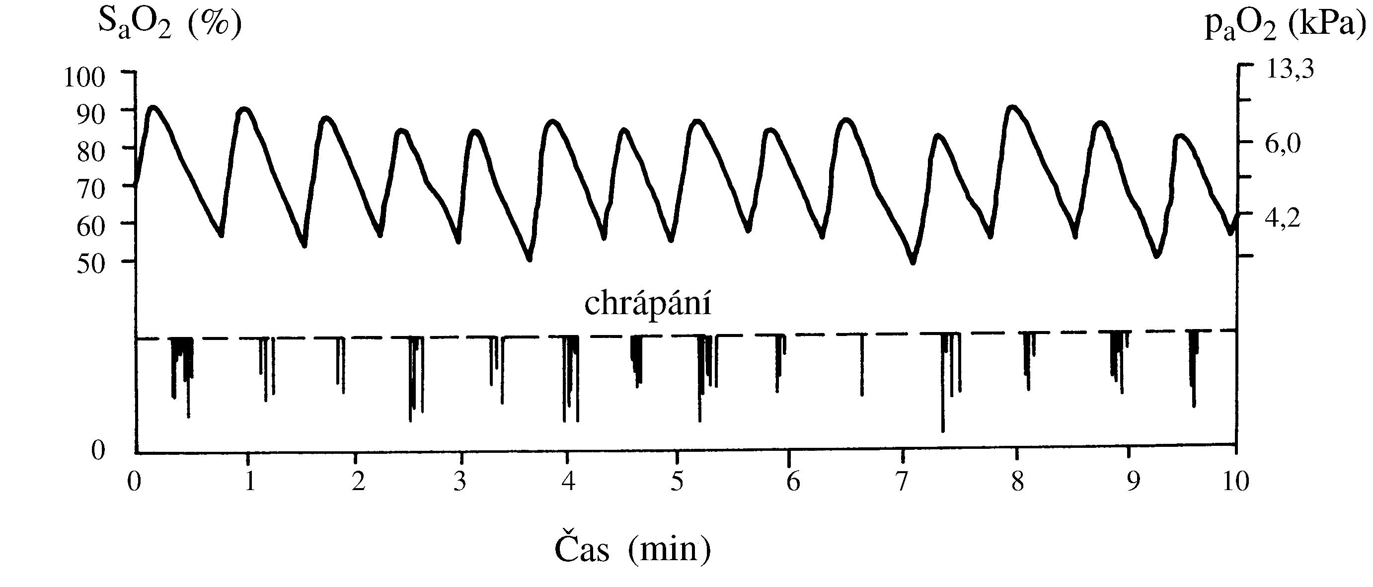 2021 Patologicka fyzio 1 Page 344 Image 0001