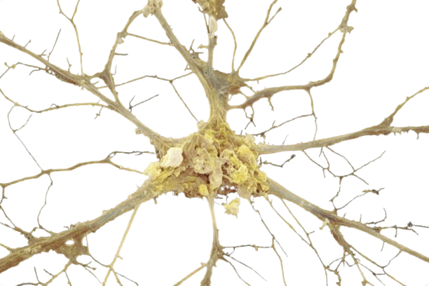 nervy-removebg-preview