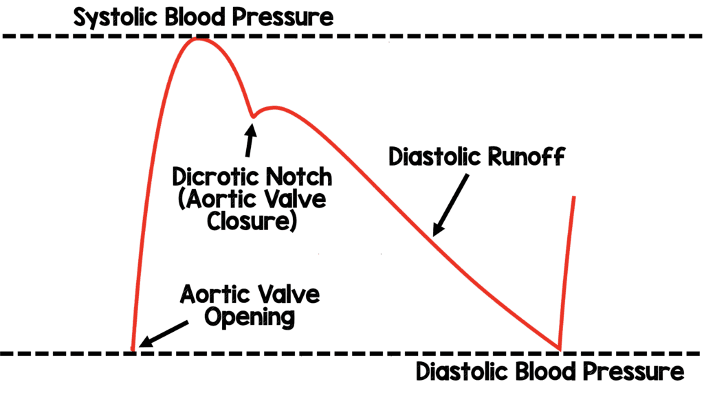 Normal-Arterial-Waveform-1024x575