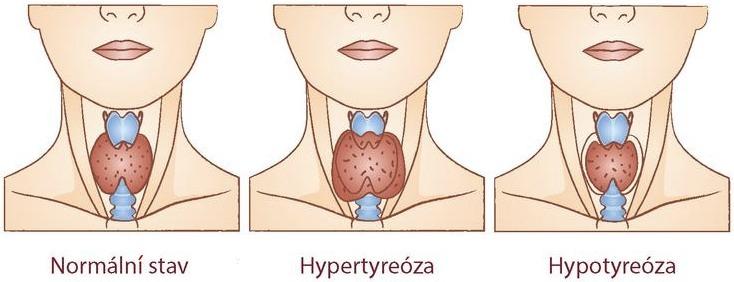 cJp6uAhnBOah s1600x1600