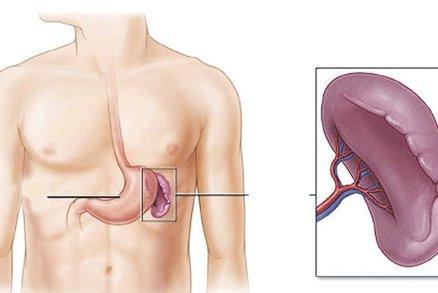 1953610 slezina-operace-babis-ano-v0