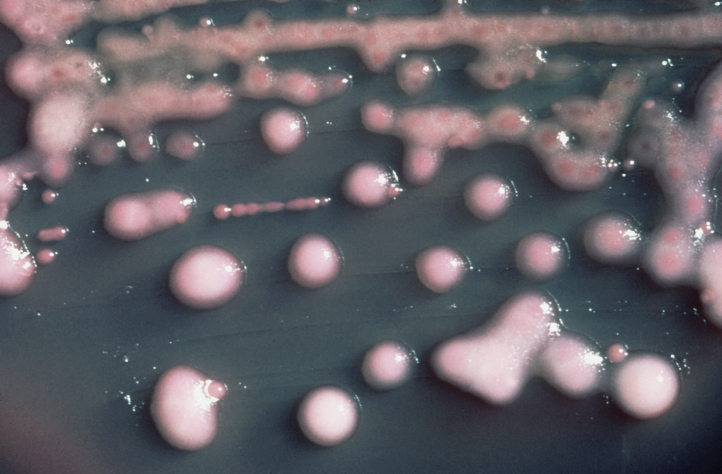 Klebsiella pneumoniae 01